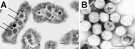 Halothiobacillus neapolitanus.jpg